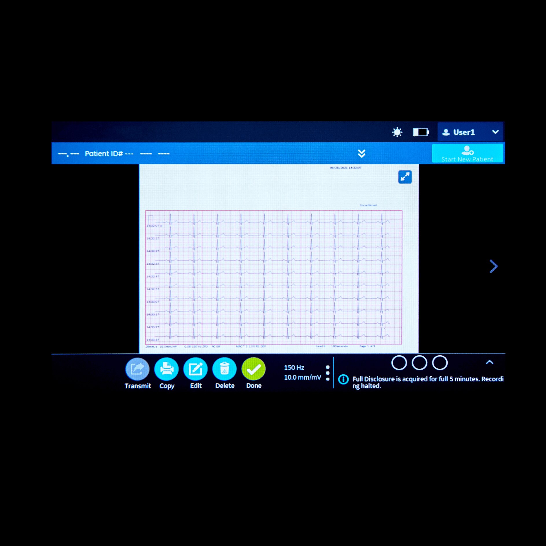 MAC™ 5 Resting ECG MAC™ 5 Resting ECG